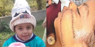 ਲੁਧਿਆਣਾ : 4 ਸਾਲਾ ਮਾਸੂਮ ਚਾਈਨਾ ਡੋਰ ਦੀ ਆਇਆ ਲਪੇਟ ‘ਚ, ਚਿਹਰੇ ‘ਤੇ ਲੱਗਾ ਡੂੰਘਾ ਕੱਟ, 120 ਟਾਂਕੇ ਲੱਗਣ ਤੋਂ ਬਾਅਦ ਵੀ ਹਾਲਤ ਗੰਭੀਰ