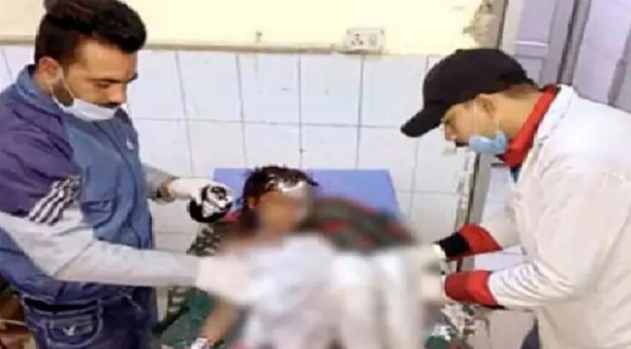 ਦਰਦਨਾਕ ! ਝੁੱਗੀ ‘ਚ ਅੱਗ ਲੱਗਣ ਕਾਰਨ ਇਕੋ ਪਰਿਵਾਰ ਦੇ 6 ਬੱਚੇ ਝੁਲਸੇ, ਹਾਲਤ ਗੰਭੀਰ