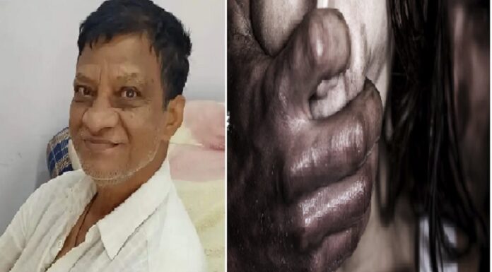 58 ਸਾਲਾ ਭਾਜਪਾ ਨੇਤਾ ਨੇ 13 ਸਾਲਾ ਬੱਚੀ ਨਾਲ ਕੀਤਾ ਬਲਾਤਕਾਰ, ਗੁੱਸੇ ‘ਚ ਲੋਕਾਂ ਨੇ ਮੁਲਜ਼ਮ ਦੀ ਕਾਰ ਨੂੰ ਲਾਈ ਅੱਗ