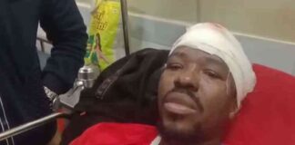 ਲੁਧਿਆਣਾ : ਬਾਈਕ ‘ਤੇ ਜਾਂਦੇ ਵਿਦੇਸ਼ੀ ਵਿਦਿਆਰਥੀ ਨਾਲ ਵਾਪਰਿਆ ਹਾਦਸਾ, ਚਾਈਨਾ ਡੋਰ ਨੇ ਕੀਤਾ ਗੰਭੀਰ ਜ਼ਖਮੀ