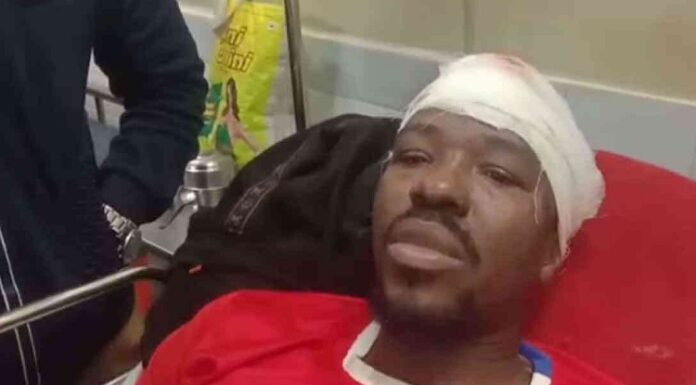 ਲੁਧਿਆਣਾ : ਬਾਈਕ ‘ਤੇ ਜਾਂਦੇ ਵਿਦੇਸ਼ੀ ਵਿਦਿਆਰਥੀ ਨਾਲ ਵਾਪਰਿਆ ਹਾਦਸਾ, ਚਾਈਨਾ ਡੋਰ ਨੇ ਕੀਤਾ ਗੰਭੀਰ ਜ਼ਖਮੀ