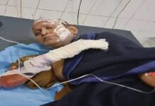 ਲੁਧਿਆਣਾ ਦੀ ਲੋਹਾ ਫੈਕਟਰੀ ‘ਚ ਹਾਦਸਾ : ਭੱਠੀ ‘ਤੇ ਕੰਮ ਕਰਦੇ ਮਜ਼ਦੂਰ ਝੁਲਸੇ; 4 ਦੀ ਹਾਲਤ ਗੰਭੀਰ