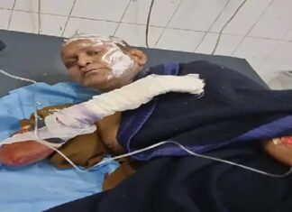 ਲੁਧਿਆਣਾ ਦੀ ਲੋਹਾ ਫੈਕਟਰੀ ‘ਚ ਹਾਦਸਾ : ਭੱਠੀ ‘ਤੇ ਕੰਮ ਕਰਦੇ ਮਜ਼ਦੂਰ ਝੁਲਸੇ; 4 ਦੀ ਹਾਲਤ ਗੰਭੀਰ