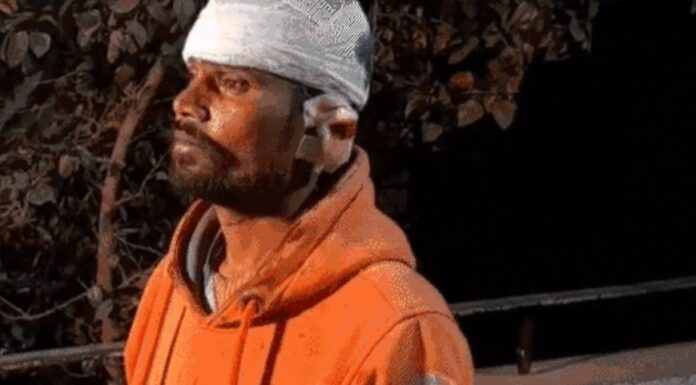 ਜਲੰਧਰ ਦੇ ਸਿਵਲ ਹਸਪਤਾਲ ‘ਚ ਗੁੰਡਾਗਰਦੀ ਦਾ ਨੰਗਾ ਨਾਚ : ਬਦਮਾਸ਼ਾਂ ਨੇ ਪੁਲਿਸ ਦੇ ਸਾਹਮਣੇ ਵੱਢੇ ਨੌਜਵਾਨ ਦੇ ਕੰਨ, ਸਿਰ ਵੀ ਪਾੜਿਆ