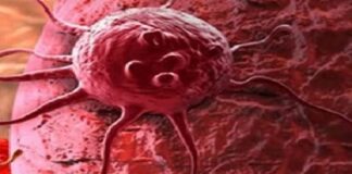 ਪੰਜਾਬ ‘ਚ ਵੱਧ ਰਿਹੈ ਕੈਂਸਰ ਦਾ ਕਹਿਰ ! 2200 ਨਵੇਂ ਮਰੀਜ਼ ਆਏ ਸਾਹਮਣੇ, ਔਰਤਾਂ ਜ਼ਿਆਦਾ ਪੀੜਤ