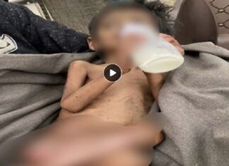 ਲੁਧਿਆਣਾ ‘ਚ ਨਸ਼ੇੜੀ ਮਾਂ ਦੀ ਕਰਤੂਤ ! ਸਾਢੇ ਤਿੰਨ ਸਾਲ ਦੇ ਬੱਚੇ ਦੀ ਨਹੀਂ ਕੀਤੀ ਦੇਖਭਾਲ, ਬੱਚਾ ਕੁਪੋਸ਼ਣ ਦਾ ਹੋਇਆ ਸ਼ਿਕਾਰ, ਪਏ ਕੀੜੇ