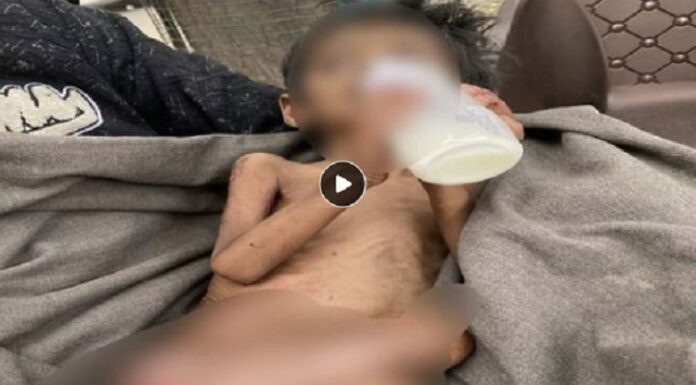 ਲੁਧਿਆਣਾ ‘ਚ ਨਸ਼ੇੜੀ ਮਾਂ ਦੀ ਕਰਤੂਤ ! ਸਾਢੇ ਤਿੰਨ ਸਾਲ ਦੇ ਬੱਚੇ ਦੀ ਨਹੀਂ ਕੀਤੀ ਦੇਖਭਾਲ, ਬੱਚਾ ਕੁਪੋਸ਼ਣ ਦਾ ਹੋਇਆ ਸ਼ਿਕਾਰ, ਪਏ ਕੀੜੇ