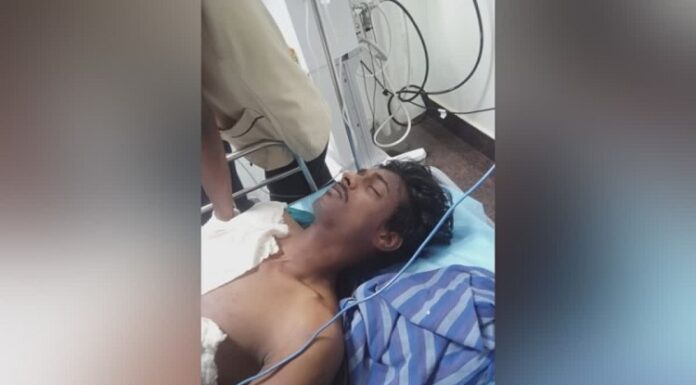 BOMB BLAST : ਬੰਬ ਬਣਾਉਂਦਿਆਂ ਹੋਇਆ ਧਮਾਕਾ, RSS ਵਰਕਰ ਨੇ ਗੁਆਏ ਆਪਣੇ ਦੋਵੇਂ ਹੱਥ