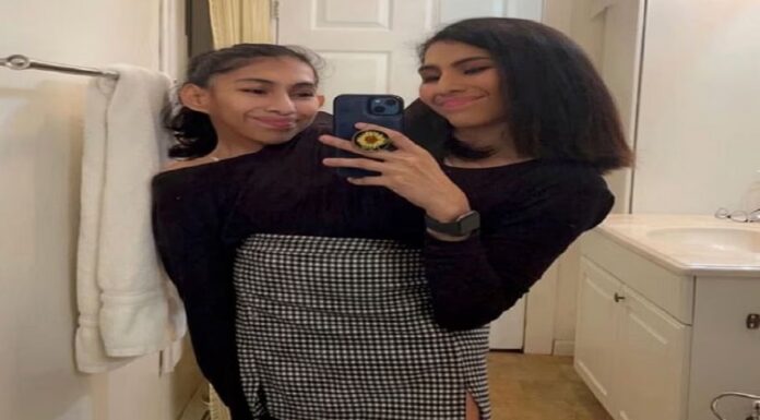 ਲੱਕ ਤੱਕ ਜੁੜੀਆਂ ਨੇ ਦੋਵੇਂ ਭੈਣਾਂ, ਇਕ ਦਾ ਬੁਆਏਫ੍ਰੈਂਡ ਤਾਂ ਦੂਜੀ ਸਿੰਗਲ, ਦੱਸਿਆ ਕਿੱਦਾਂ ਚਲਦਾ ਰੋਮਾਂਸ