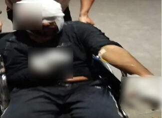 ਜਲੰਧਰ ‘ਚ ਸੂਰਿਆ ਇਨਕਲੇਵ ਨੇੜੇ ਨੌਜਵਾਨ ’ਤੇ ਕਾਤਲਾਨਾ ਹਮਲਾ, ਵੱਢਿਆ ਹੱਥ, ਅੱਖਾਂ ਨੋਚੀਆਂ, ਹਾਲਤ ਸੀਰੀਅਸ