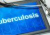 ਪੰਜਾਬ ‘ਚ ਟੀਬੀ ਦੇ ਮਰੀਜ਼ਾਂ ਨੂੰ ਮਿਲੇਗੀ ਰਾਹਤ : 7 ਜ਼ਿਲ੍ਹਿਆਂ ਦੇ ਹਸਪਤਾਲਾਂ ‘ਚ ਲਗਾਇਆ ਜਾਵੇਗਾ ਇਹ ਸਾਫ਼ਟਵੇਅਰ