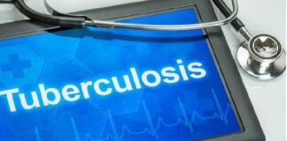 ਪੰਜਾਬ ‘ਚ ਟੀਬੀ ਦੇ ਮਰੀਜ਼ਾਂ ਨੂੰ ਮਿਲੇਗੀ ਰਾਹਤ : 7 ਜ਼ਿਲ੍ਹਿਆਂ ਦੇ ਹਸਪਤਾਲਾਂ ‘ਚ ਲਗਾਇਆ ਜਾਵੇਗਾ ਇਹ ਸਾਫ਼ਟਵੇਅਰ