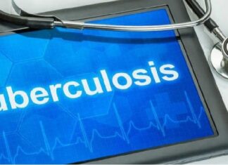 ਪੰਜਾਬ ‘ਚ ਟੀਬੀ ਦੇ ਮਰੀਜ਼ਾਂ ਨੂੰ ਮਿਲੇਗੀ ਰਾਹਤ : 7 ਜ਼ਿਲ੍ਹਿਆਂ ਦੇ ਹਸਪਤਾਲਾਂ ‘ਚ ਲਗਾਇਆ ਜਾਵੇਗਾ ਇਹ ਸਾਫ਼ਟਵੇਅਰ