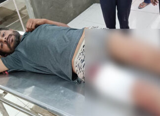 ਸੁਨਾਮ : ਬਾਈਕ ਸਵਾਰਾਂ ਨੇ ਨੌਜਵਾਨ ਨੂੰ ਮਾਰੀ ਗੋਲ਼ੀ, ਚਿੱਟਾ ਸਮੱਗਲਰਾਂ ਨੂੰ ਫੜਨ ਦੀ ਕੀਤੀ ਸੀ ਕੋਸ਼ਿਸ਼