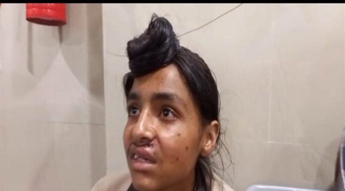 ਸਕੂਲਾਂ ਤੱਕ ਪੁੱਜੀ ਬਦਮਾਸ਼ੀ : ਪਟਿਆਲਾ ‘ਚ ਅਧਿਆਪਕ ਮੂਹਰੇ ਵਿਦਿਆਰਥੀ ‘ਤੇ ਰਾਡਾਂ ਨਾਲ ਹਮਲਾ, ਦੰਦ ਭੰਨੇ