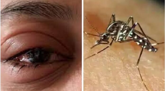 ਪੰਜਾਬ ‘ਚ ਡੇਂਗੂ ਦੇ 440 ਮਾਮਲੇ ਆਏ ਸਾਹਮਣੇ, ਅੱਖਾਂ ‘ਚ ਫਲੂ ਦਾ ਖ਼ਤਰਾ ਵੀ ਵਧਿਆ