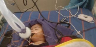 ਜਲੰਧਰ : ਗਲ਼ਤ ਸਾਈਡ ਤੋਂ ਆ ਰਹੇ ਬਾਈਕ ਸਵਾਰ ਨੀਗਰੋ ਨੇ ਐਕਟਿਵਾ ਨੂੰ ਮਾਰੀ ਟੱਕਰ, ਚਾਲਕ ਦੀ ਲੱਤ ਟੁੱਟੀ, ਮਾਸੂਮ ਬੇਟੀ ਸੀਰੀਅਸ