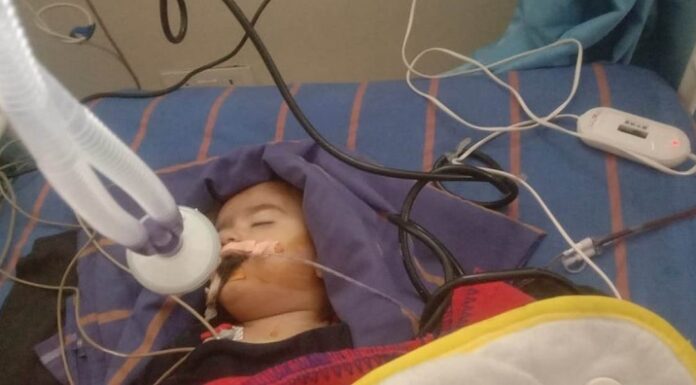 ਜਲੰਧਰ : ਗਲ਼ਤ ਸਾਈਡ ਤੋਂ ਆ ਰਹੇ ਬਾਈਕ ਸਵਾਰ ਨੀਗਰੋ ਨੇ ਐਕਟਿਵਾ ਨੂੰ ਮਾਰੀ ਟੱਕਰ, ਚਾਲਕ ਦੀ ਲੱਤ ਟੁੱਟੀ, ਮਾਸੂਮ ਬੇਟੀ ਸੀਰੀਅਸ