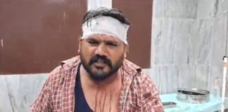 ਗੁਰਦਾਸਪੁਰ : ਬੱਚਿਆਂ ਤੋਂ ਸ਼ੁਰੂ ਹੋਈ ਲੜਾਈ ਨੇ ਧਾਰਿਆ ਭਿਆਨਕ ਰੂਪ, ਚੱਲੀਆਂ ਗੋਲ਼ੀਆਂ, 3 ਗੰਭੀਰ ਜ਼ਖਮੀ