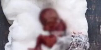 ਲੁਧਿਆਣਾ ‘ਚ ਹਸਪਤਾਲ ਦੇ ਬਾਥਰੂਮ ‘ਚੋਂ ਮਿਲਿਆ ਭਰੂਣ: ਸੁਰੱਖਿਆ ਗਾਰਡ ਨੇ ਦੇਖਿਆ; ਪੁਲਿਸ ਸੀਸੀਟੀਵੀ ਕੈਮਰਿਆਂ ਦੀ ਫੁਟੇਜ ਦੀ ਜਾਂਚ ‘ਚ ਰੁੱਝੀ