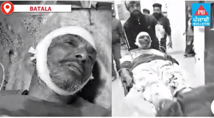 ਬਟਾਲਾ : ਦੋ ਧਿਰਾਂ ਦੀ ਲੜਾਈ ਛੁਡਵਾਉਣ ਗਏ ਗੁਆਂਢੀ ਦਾ ਹੀ ਪਾੜਿਆ ਸਿਰ, ਸੀਰੀਅਸ ਹਾਲਤ ‘ਚ ਹਸਪਤਾਲ ਦਾਖਲ
