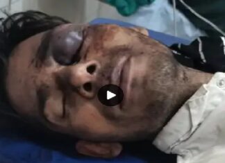 ਲੁਧਿਆਣਾ ‘ਚ ਲਿਫਟ ਮੰਗ ਕੇ 3 ਬਦਮਾਸ਼ਾਂ ਨੇ ਲੁੱਟਿਆ ਨੌਜਵਾਨ, ਸਿਰ ਤੇ ਮੂੰਹ ‘ਤੇ ਮਾਰੀਆਂ ਸੱਟਾਂ