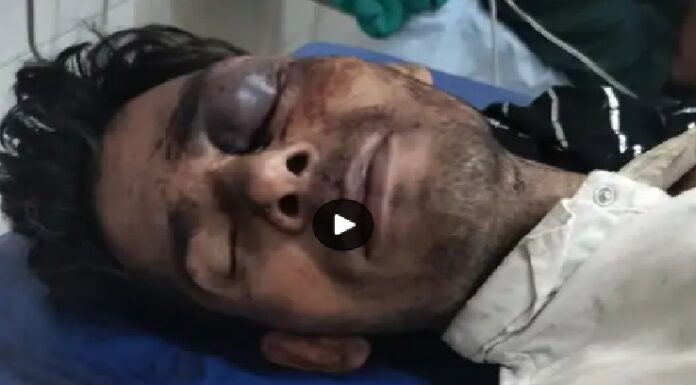 ਲੁਧਿਆਣਾ ‘ਚ ਲਿਫਟ ਮੰਗ ਕੇ 3 ਬਦਮਾਸ਼ਾਂ ਨੇ ਲੁੱਟਿਆ ਨੌਜਵਾਨ, ਸਿਰ ਤੇ ਮੂੰਹ ‘ਤੇ ਮਾਰੀਆਂ ਸੱਟਾਂ