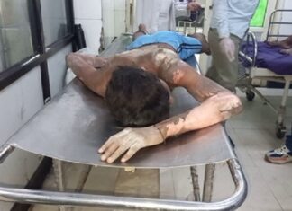 ਫਿਰੋਜ਼ਪੁਰ : ਗੁਰਦੁਆਰਾ ਸਾਹਿਬ ‘ਚ ਫੱਟਿਆ ਗੈਸ ਸਿਲੰਡਰ, ਸੇਵਾ ਕਰਨ ਆਏ 5 ਸਕੂਲੀ ਬੱਚੇ ਬੁਰੀ ਤਰ੍ਹਾਂ ਝੁਲਸੇ