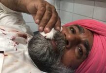 ਜ਼ੀਰਾ ‘ਚ ਫਿਰ ਚੱਲੀਆਂ ਗੋਲੀਆਂ ਦੋ ਲੋਕ ਹੋਏ ਜ਼ਖਮੀ, ਇੱਕ ਨੂੰ ਫਰੀਦਕੋਟ ਕੀਤਾ ਰੈਫਰ