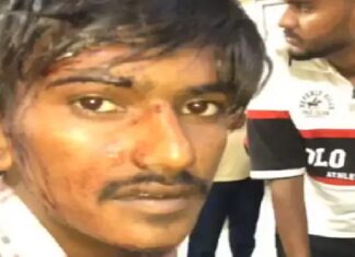 ਮਾਮੂਲੀ ਜਿਹੀ ਗੱਲ ਪਿੱਛੇ ਬੇਕਰੀ ‘ਚ ਕੰਮ ਕਰਦੇ ਮੁੰਡੇ ‘ਤੇ ਜਾਨਲੇਵਾ ਹਮਲਾ, ਰਾਹ ‘ਚ ਘੇਰ ਮਾਰੀਆਂ ਸੱਟਾਂ