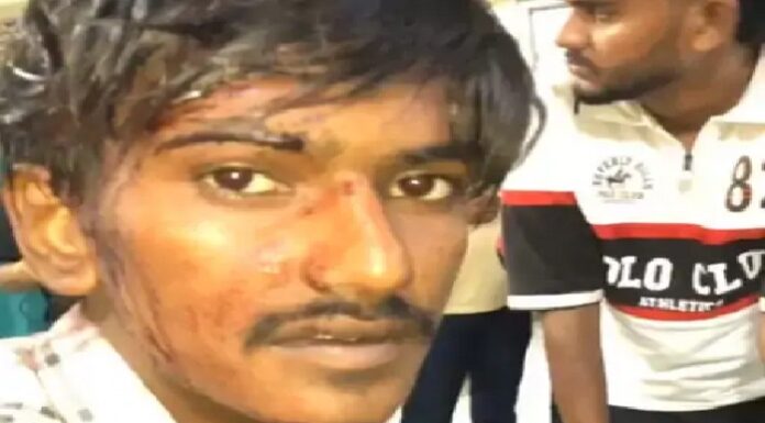 ਮਾਮੂਲੀ ਜਿਹੀ ਗੱਲ ਪਿੱਛੇ ਬੇਕਰੀ ‘ਚ ਕੰਮ ਕਰਦੇ ਮੁੰਡੇ ‘ਤੇ ਜਾਨਲੇਵਾ ਹਮਲਾ, ਰਾਹ ‘ਚ ਘੇਰ ਮਾਰੀਆਂ ਸੱਟਾਂ