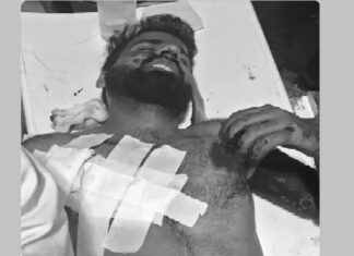 ਵੱਡੀ ਖਬਰ ! ਜੰਮੂ-ਕਸ਼ਮੀਰ ‘ਚ ਅੱਤਵਾਦੀ ਹਮਲਾ, ਡਾਕਟਰ ਸਮੇਤ 7 ਲੋਕਾਂ ਦੀ ਮੌਤ, 5 ਜ਼ਖਮੀ