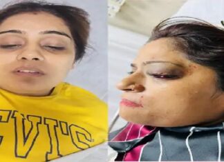 ਲੁਧਿਆਣਾ ‘ਚ ਤੇਜ਼ ਰਫਤਾਰ ਫਾਰਚੂਨਰ ਨੇ ਕਾਰ ਨੂੰ ਮਾਰੀ ਜ਼ੋਰਦਾਰ ਟੱਕਰ, 2 ਔਰਤਾਂ ਸਣੇ 4 ਜ਼ਖਮੀ