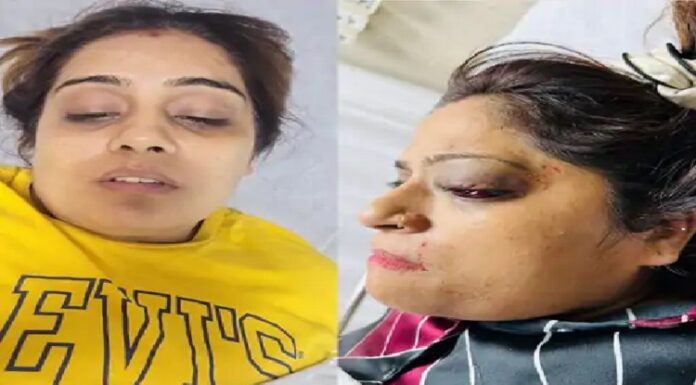 ਲੁਧਿਆਣਾ ‘ਚ ਤੇਜ਼ ਰਫਤਾਰ ਫਾਰਚੂਨਰ ਨੇ ਕਾਰ ਨੂੰ ਮਾਰੀ ਜ਼ੋਰਦਾਰ ਟੱਕਰ, 2 ਔਰਤਾਂ ਸਣੇ 4 ਜ਼ਖਮੀ