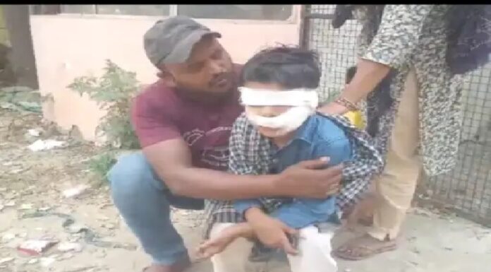 ਲੁਧਿਆਣਾ ‘ਚ ਟਿਊਸ਼ਨ ਪੜ੍ਹ ਕੇ ਘਰ ਜਾ ਰਹੇ ਬੱਚੇ ਨੂੰ ਕੁੱਤੇ ਨੇ ਨੋਚਿਆ, ਬੁਰੀ ਤਰ੍ਹਾਂ ਕੀਤਾ ਜ਼ਖਮੀ