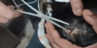 ਲੁਧਿਆਣਾ ‘ਚ ਛੱਤ ‘ਤੇ ਪਤੰਗਬਾਜ਼ੀ ਦੇਖ ਰਹੀ 11 ਸਾਲ ਦੀ ਬੱਚੀ ਦੇ ਲੱਗੀ ਗੋਲੀ, ਹਵਾਈ ਫਾਇਰ ਆ ਕੇ ਸਿਰ ‘ਚ ਵੱਜਿਆ