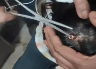 ਲੁਧਿਆਣਾ ‘ਚ ਛੱਤ ‘ਤੇ ਪਤੰਗਬਾਜ਼ੀ ਦੇਖ ਰਹੀ 11 ਸਾਲ ਦੀ ਬੱਚੀ ਦੇ ਲੱਗੀ ਗੋਲੀ, ਹਵਾਈ ਫਾਇਰ ਆ ਕੇ ਸਿਰ ‘ਚ ਵੱਜਿਆ