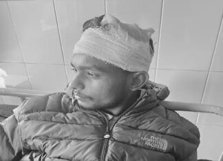 ਗੁਆਂਢੀਆਂ ‘ਚ ਹੋਈ ਲੜਾਈ ਨੇ ਧਾਰਿਆ ਖੂਨੀ ਰੂਪ, ਰਸਤੇ ‘ਚ ਘੇਰ ਕੇ ਇਕ-ਦੂਜੇ ਦੇ ਮਾਰੀਆਂ ਸੱਟਾਂ, 7 ਜ਼ਖਮੀ