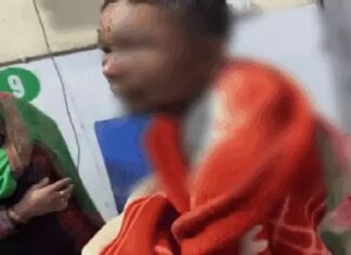 ਲੁਧਿਆਣਾ ‘ਚ ਸਟੋਵ ‘ਤੇ ਮੂੰਹ ਦੇ ਭਾਰ ਡਿੱਗਿਆ ਵਿਅਕਤੀ, ਸ਼ਰਾਬ ਪੀ ਕੇ ਬਣਾ ਰਿਹਾ ਸੀ ਖਾਣਾ, 80 ਫੀਸਦੀ ਸੜਿਆ ਚਿਹਰਾ